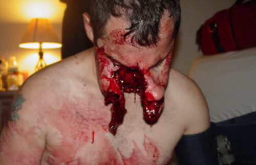 Fotos horribles de un hombre mordido por pitbull