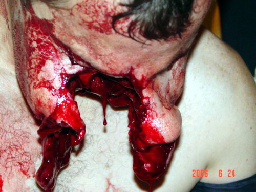 Fotos horribles de un hombre mordido por pitbull