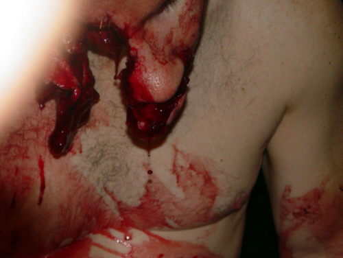 Fotos horribles de un hombre mordido por pitbull